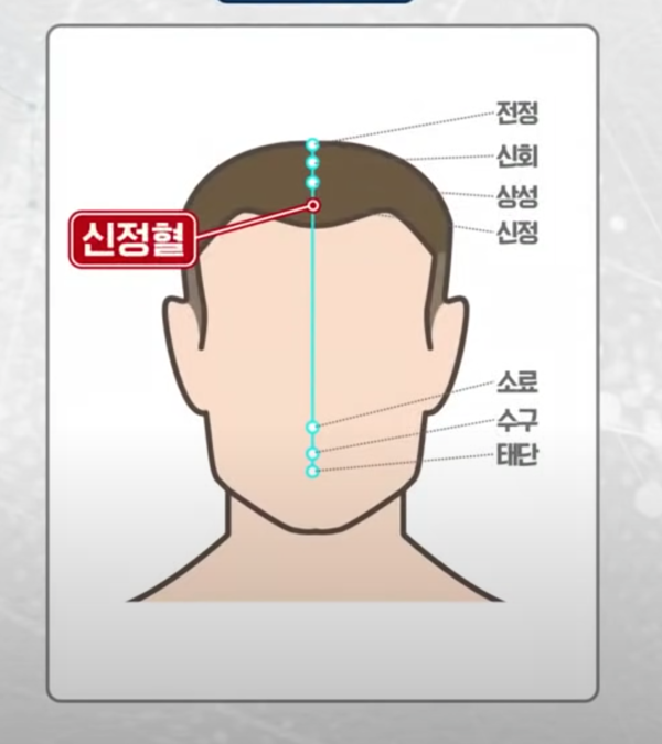 *사진=채널A '나는 몸신이다' 방송 캡처