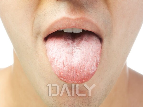 혓바늘, 입냄새 등 입속 증상으로 알