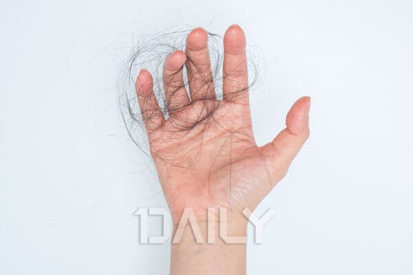 나도 M자탈모? 탈모가 의심되는 증상
