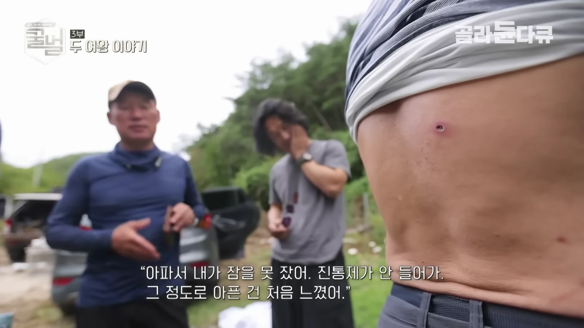 야외에서 한 남성이 벌에 쏘여 붉게 부어오른 등 부위를 보여주고 있고, 그 뒤로 두 남성이 서 있는 모습