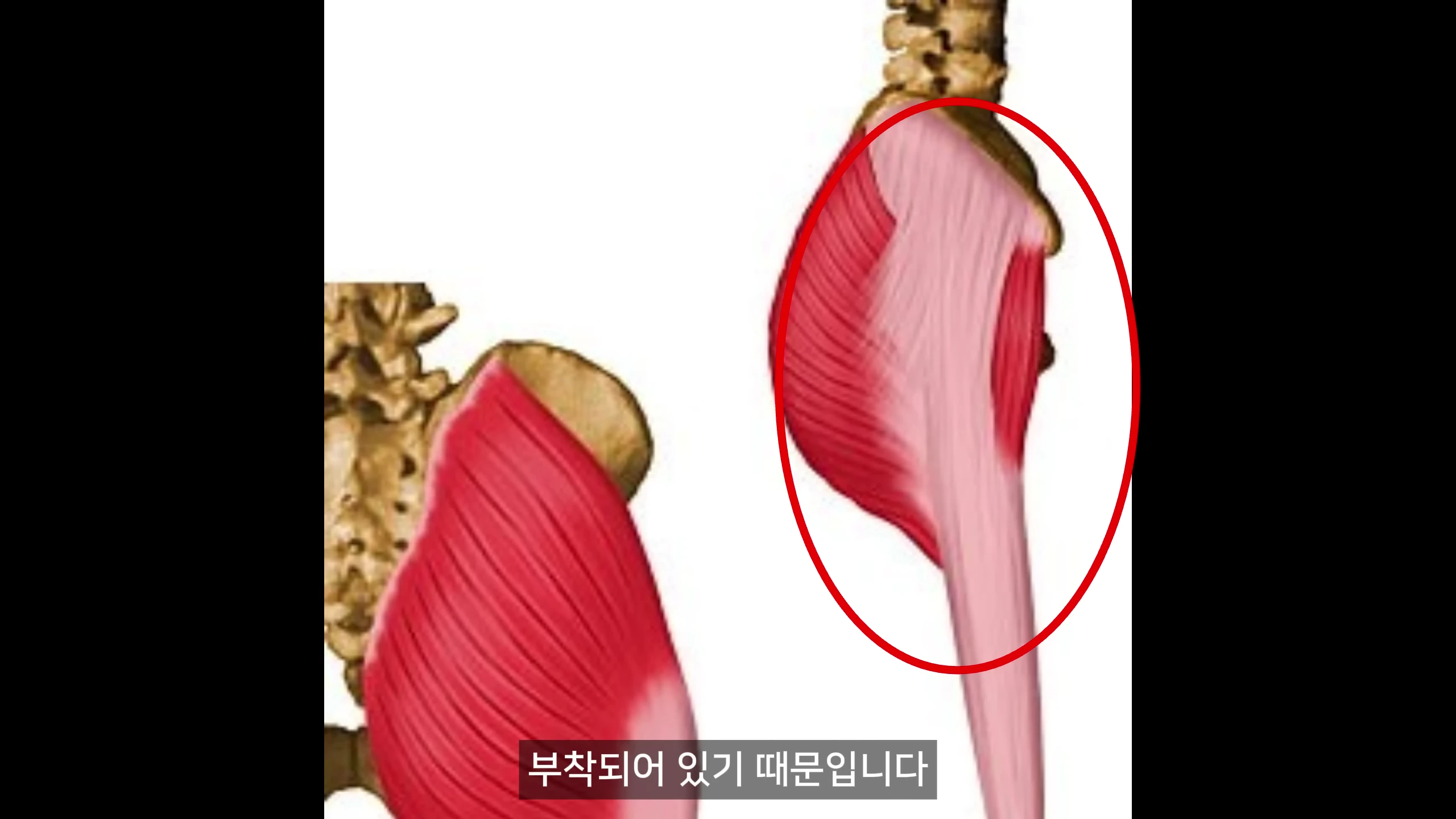 골반과 대퇴근막의 해부학적 구조를 보여주는 의료용 삽화