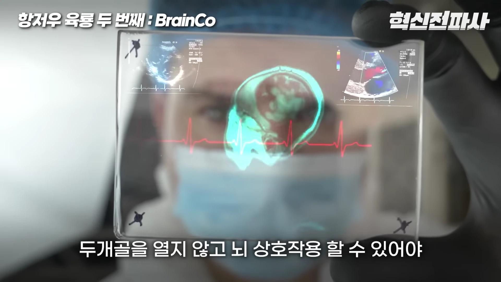 장갑을 낀 손이 투명한 스크린을 들고 있으며, 스크린에는 뇌 스캔 영상과 심전도 데이터가 표시되어 있다.