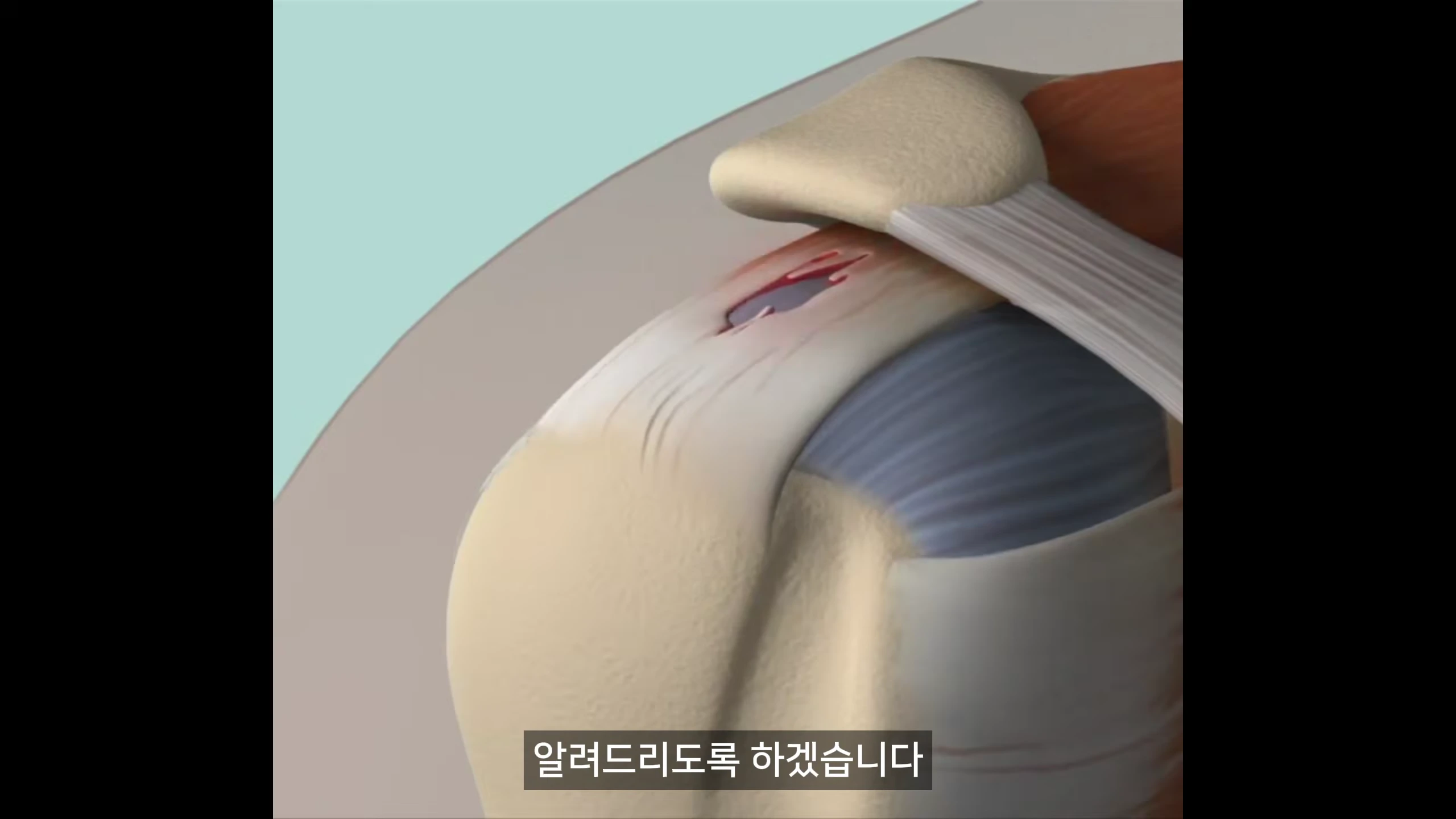 어깨 관절의 해부학적 구조를 보여주는 3D 그래픽 영상
