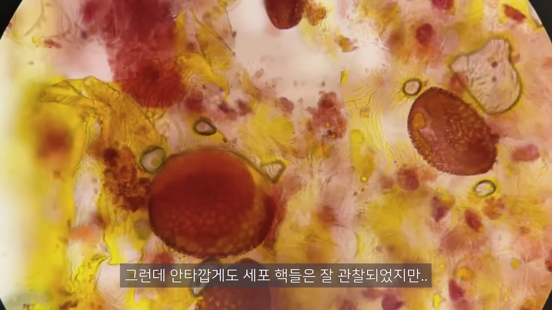 현미경을 통해 관찰한 식물 세포 샘플로, 붉은색과 노란색으로 염색된 여러 개의 둥근 세포 핵과 세포 구조물이 배경에 흩어져 있는 모습입니다.