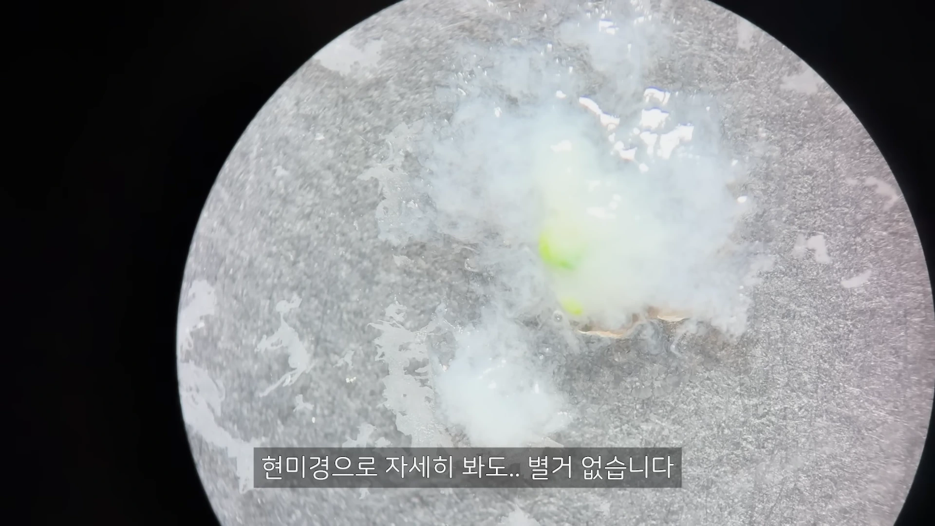 현미경 렌즈를 통해 관찰되는 희고 불투명한 액체와 작은 덩어리들의 모습
