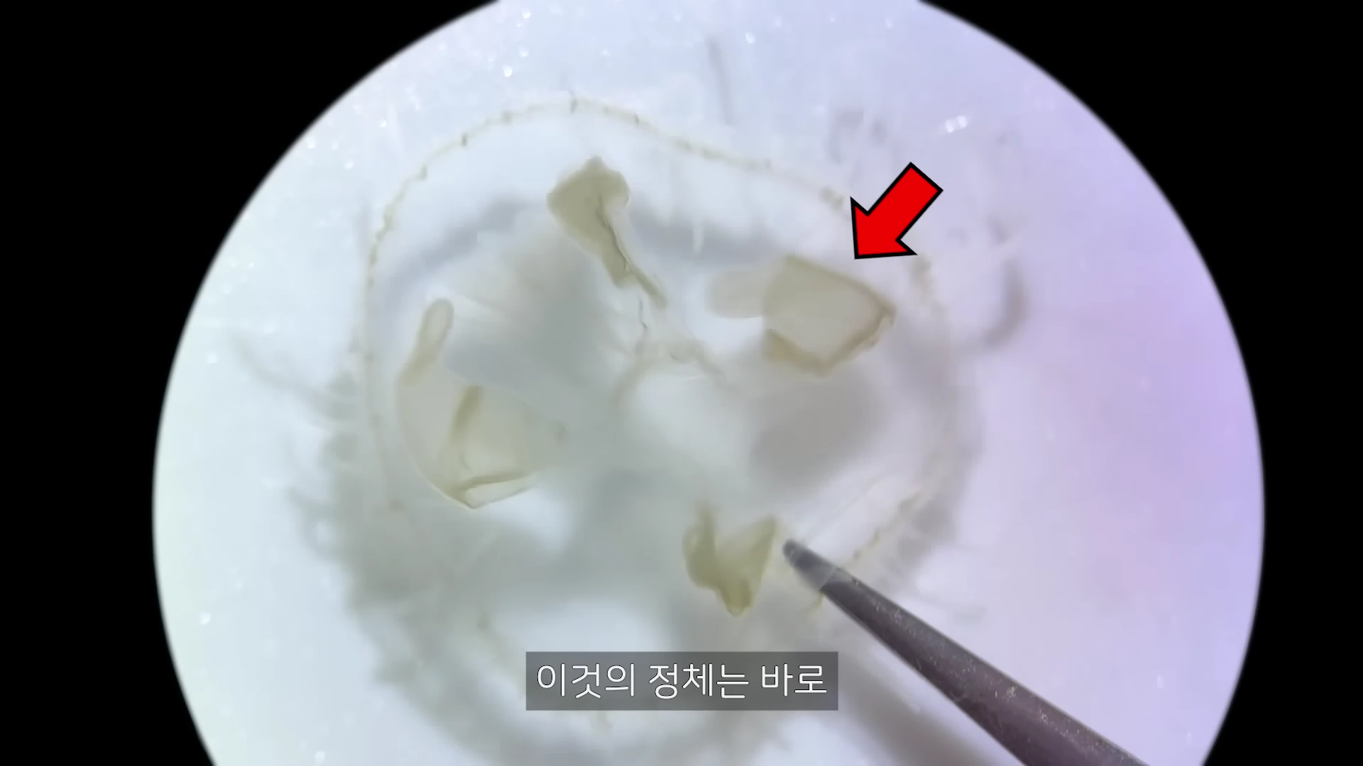 현미경 아래에서 핀셋으로 고정된 투명한 민물해파리의 내부 구조이며, 빨간 화살표가 방사 수관을 따라 위치한 부위를 가리키고 있다.