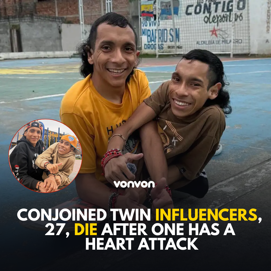 Conjoined Twin Influencers, 27, Die After One Has a Heart Attack - egloos